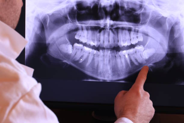 Best Same-Day Emergency Dental Services in Snyder, TX